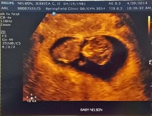 Baby Nelson first ultrasound